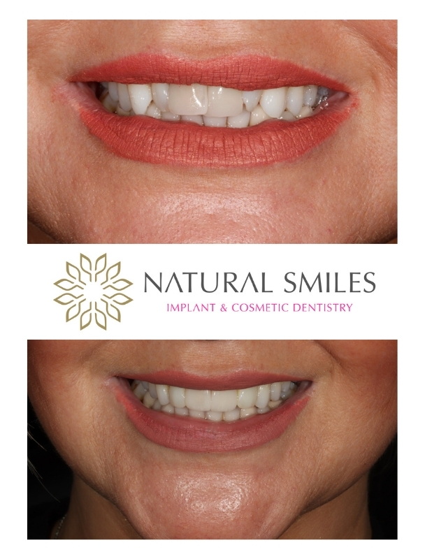 Cosmetic Dentist Leicester and Corby