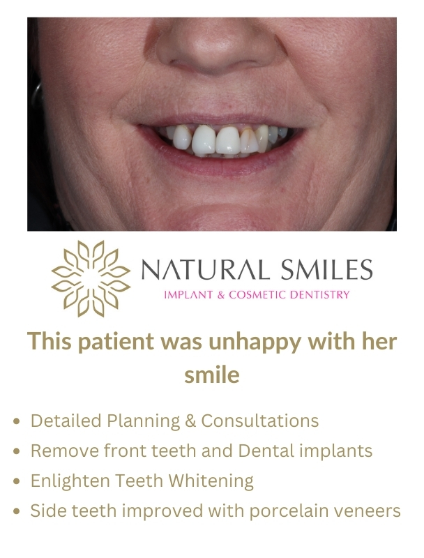 Cosmetic Dentist Leicester and Corby Planning 1