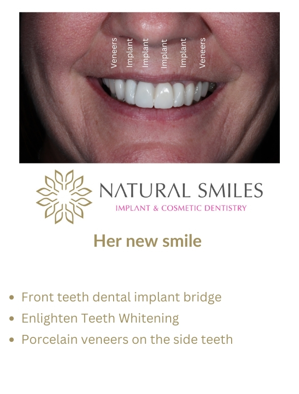 Cosmetic Dentist Leicester and Corby Planning 2