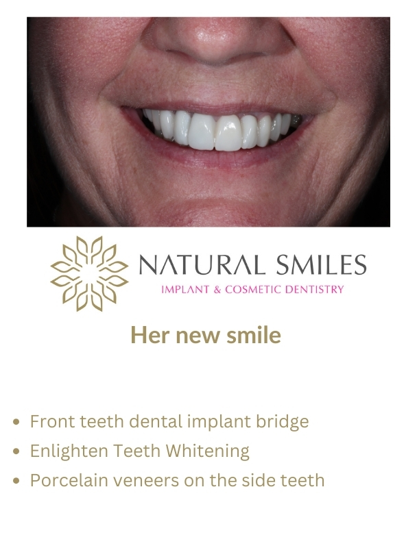 Cosmetic Dentist Leicester and Corby Planning 3